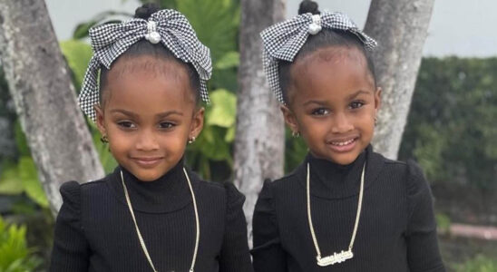 VIDEO: Las niñas de Amara La Negra ya tienen la profesión que quieren estudiar y lo hacen muy bien 31 amara1 1 SOY CHALUPA