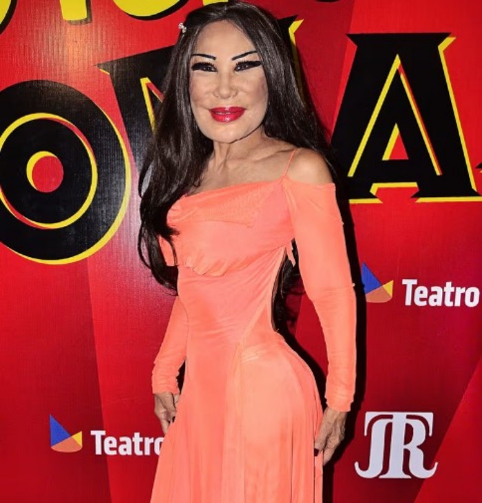 La impactante confesión de Lyn May sobre el cambio en su rostro y el momento en que pensó no volver a mirarse al espejo 7 PROTAGONISTA