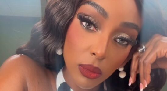 ¿Se operó? Amara La Negra responde a quienes dicen que se operó la nariz 1 Amara La Negra