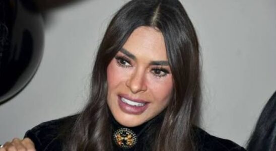 Galilea Montijo rompe el silencio sobre lo que hizo a su rostro - VIDEO 1 uyasdtf SOY CHALUPA