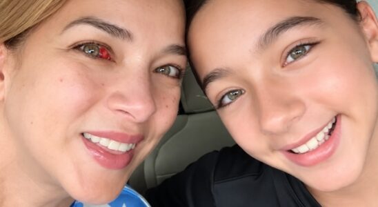 VIDEO: Adamari López preocupa a sus compañeras de Univisión al aparecer con un ojo rojo, ¿qué le pasó? 13 Adamari Lopez